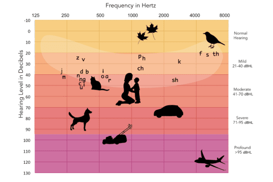 Understanding-Pure-tone-Audiogram-Thresholds